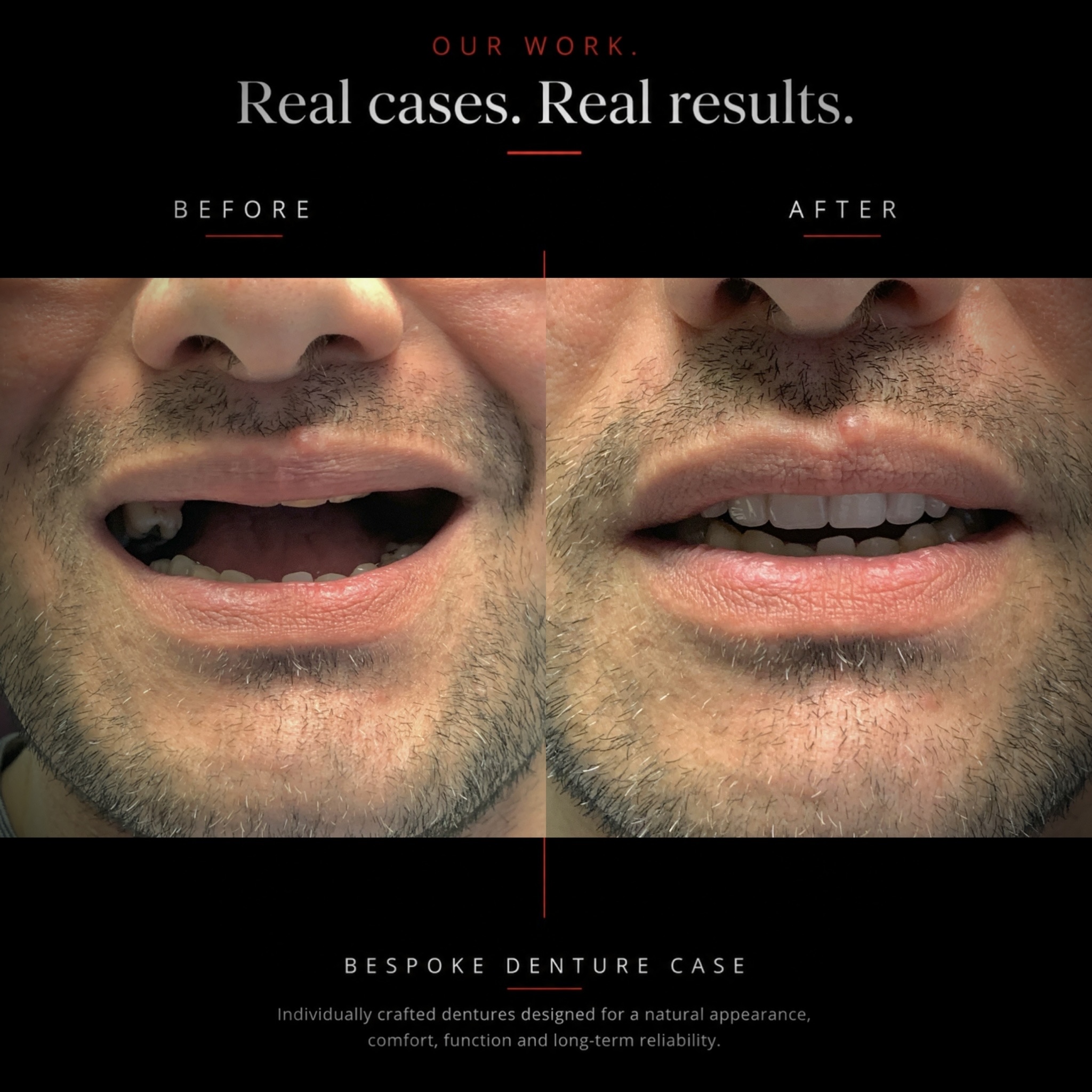 Before and after dental case