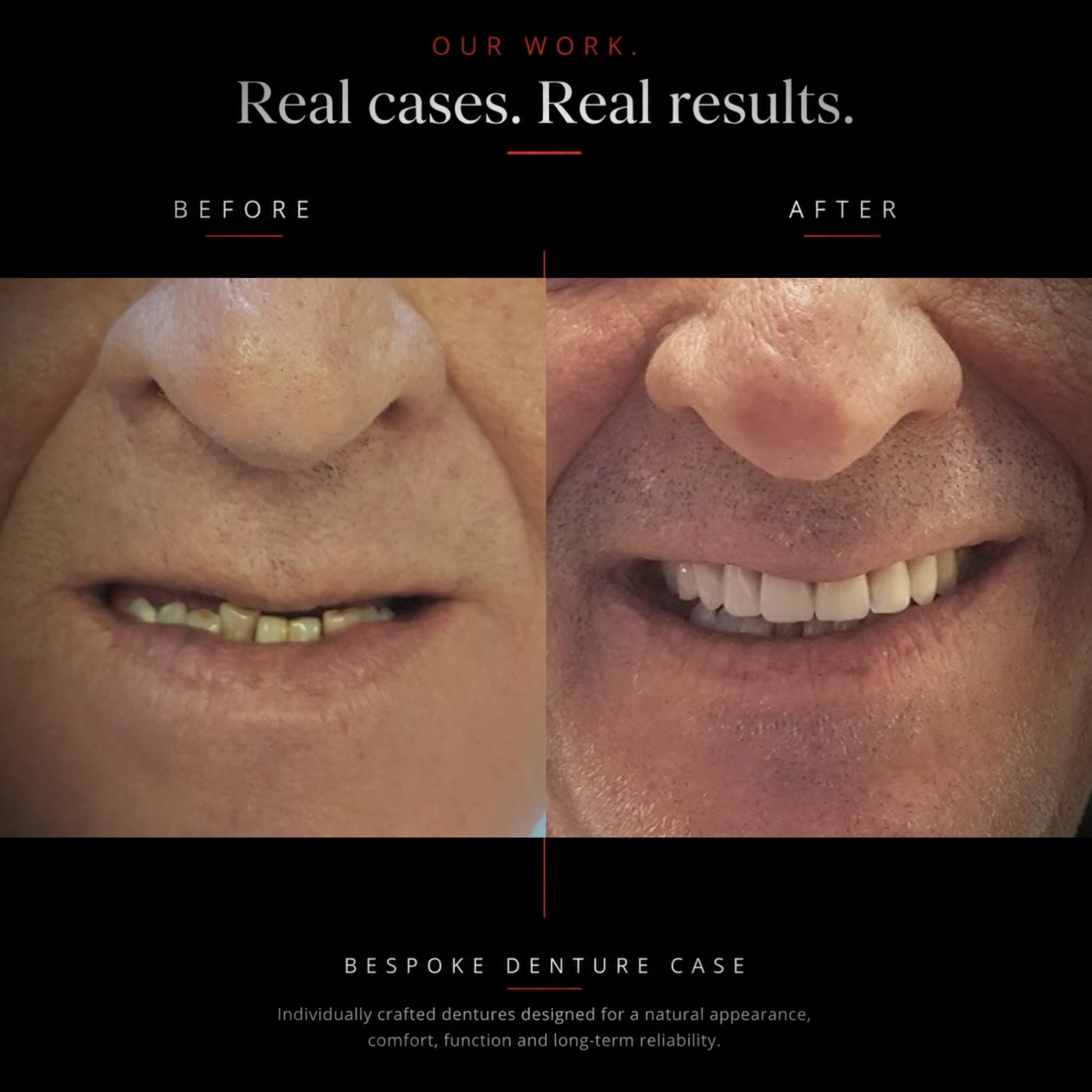 Before and after dental case