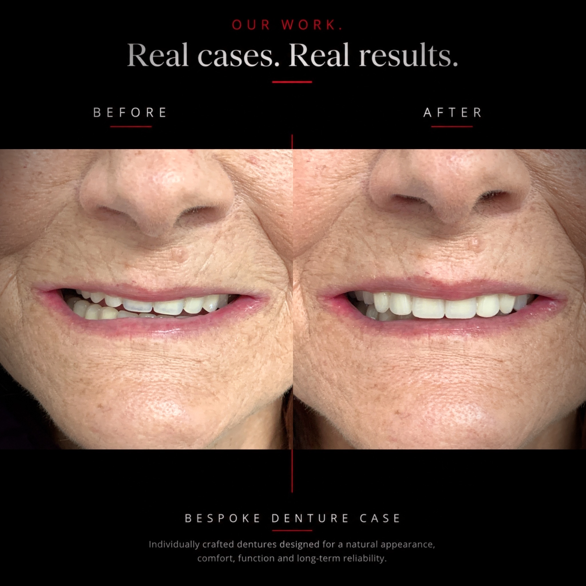 Before and after dental case