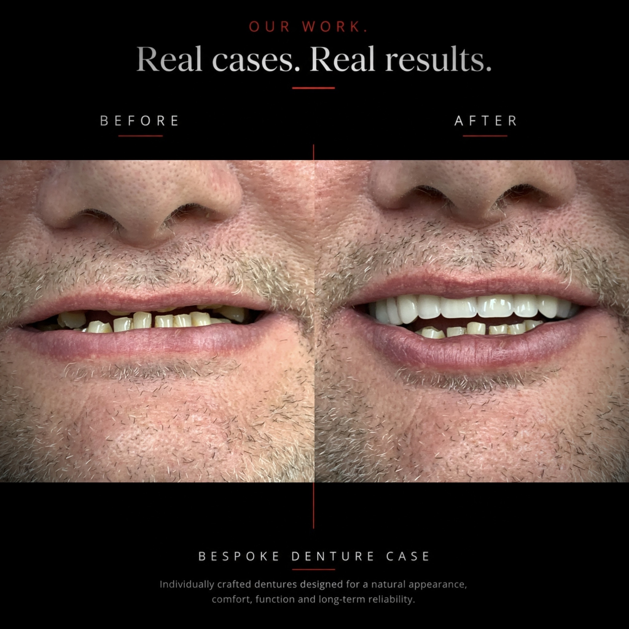 Before and after dental case