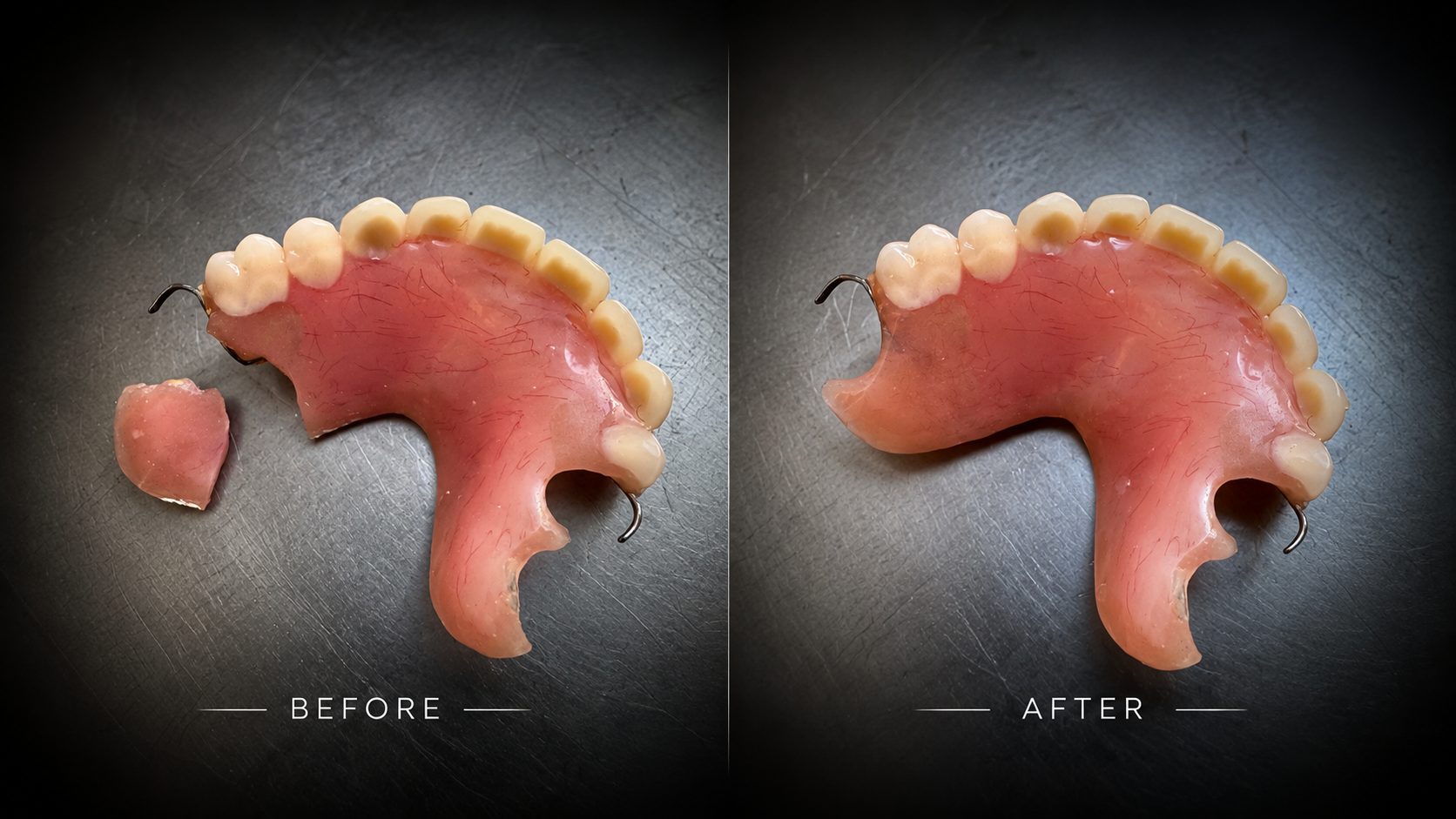 Before and after denture repair